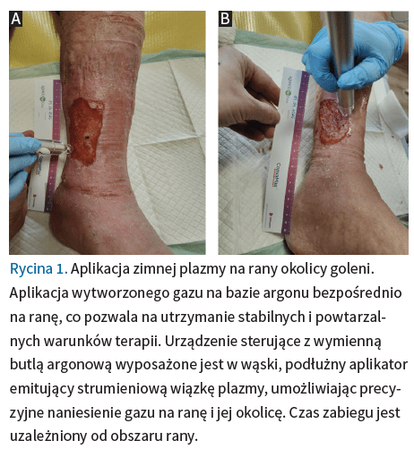 Fig. 1 Podmiotko LR 2 2026