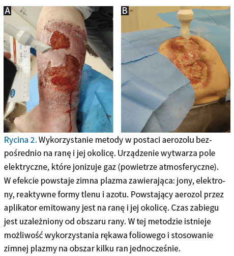 Fig. 2 Podmiotko LR 2 2026